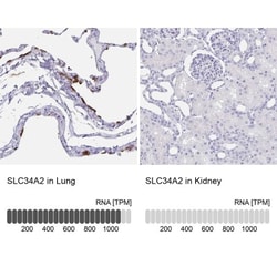 SLC34A2 Antibody, Novus Biologicals 25ul | Buy Online | Novus Biologicals | Fisher Scientific